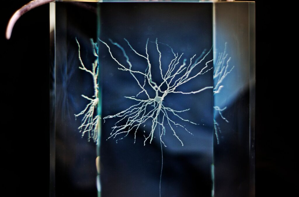 Neuron