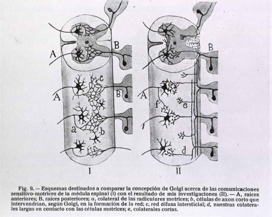 A schematic illustration of a section of the spinal cord depicting the nerve roots