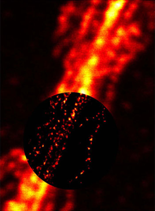 The STED microscopy (circular inset image) provides approximately ten times sharper details of filament structures within a nerve cell compared to a conventional light microscope (outer image). Â© G. Donnert, S. W. Hell 