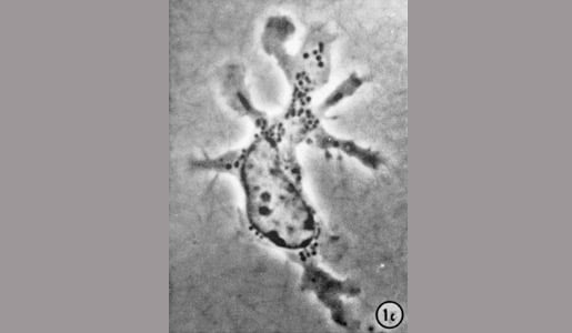 High-resolution image of a dendritic cell made by Ralph Steinman in 1973