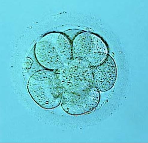 An early embryo