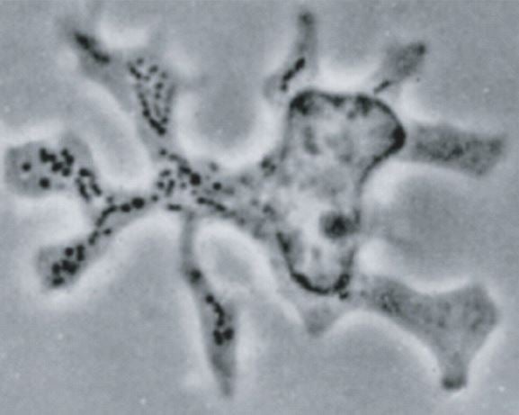 Photo of a dendritic cell