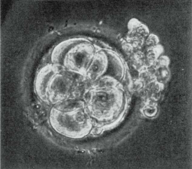 Picture of 8-cell stage human embryo resulting from IVF