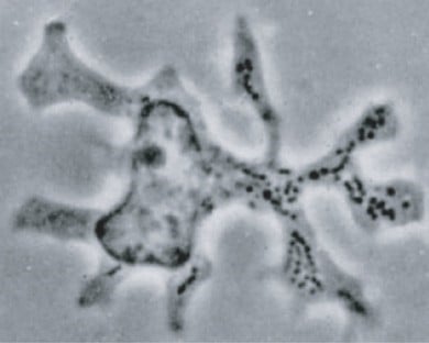 Phase contrast micrograph of a dendritic cell